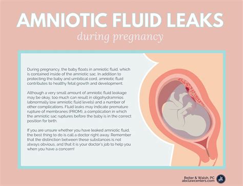 does leaking amniotic fluid smell|Leaking Amniotic Fluid: Signs in 1st to 3rd Trimester